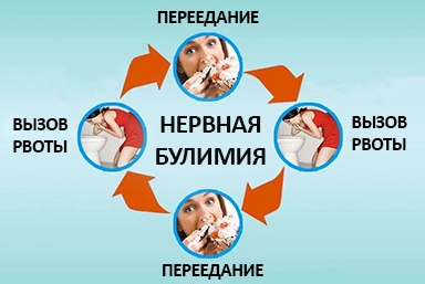 Лечение булимии в Заюково